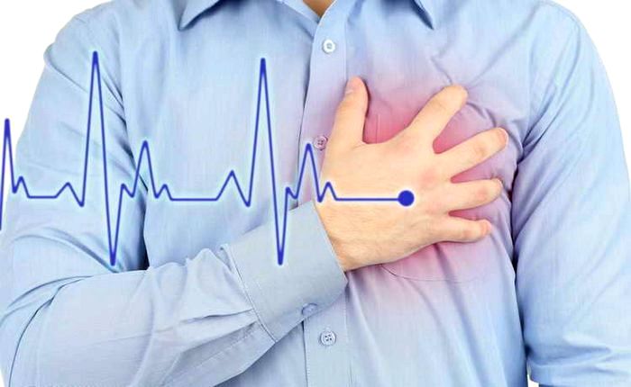 Аритмия: эффективные методы остановки приступа и восстановления нормального ритма сердца. Все о симптомах, причинах и наиболее эффективных способах помощи. Советы экспертов только на нашем сайте.